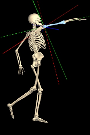 Scapula floating on posterior ribs.